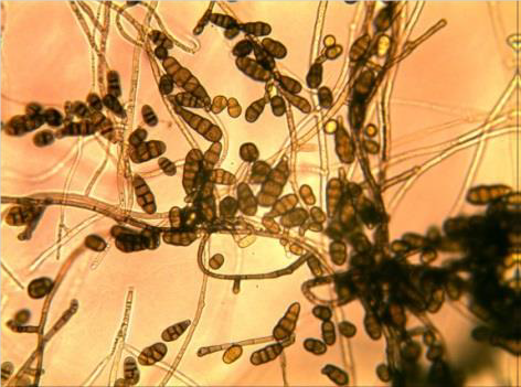 显微镜下链格孢霉菌丝和孢子形态