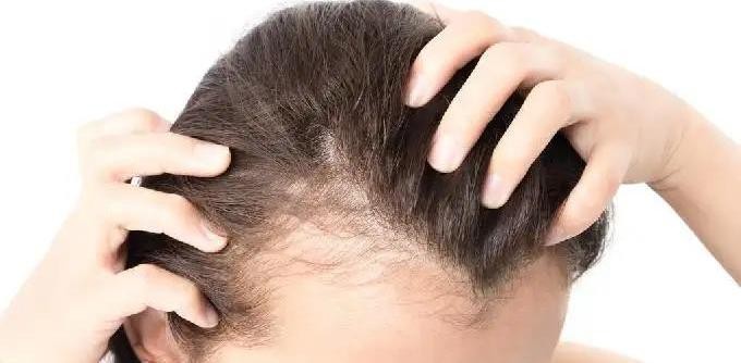 还在为“发肤甲”问题困扰？生物素的作用与功效先了解下